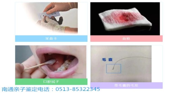南通亲子鉴定|用专业检测,还家庭一份心安