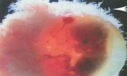 胎儿亲子鉴定的方法有几种?