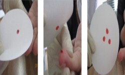 个人亲子鉴定需要准备什么？