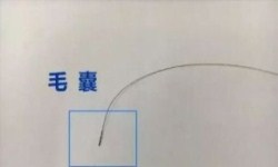 不想被别人知道的方法就是做隐私亲子鉴定
