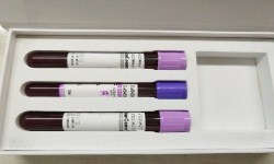 胎儿怎样做亲子鉴定确定亲生关系?